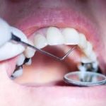 Mercury-Free Dentists—Pioneers and Catalysts for 21st Century Health Care